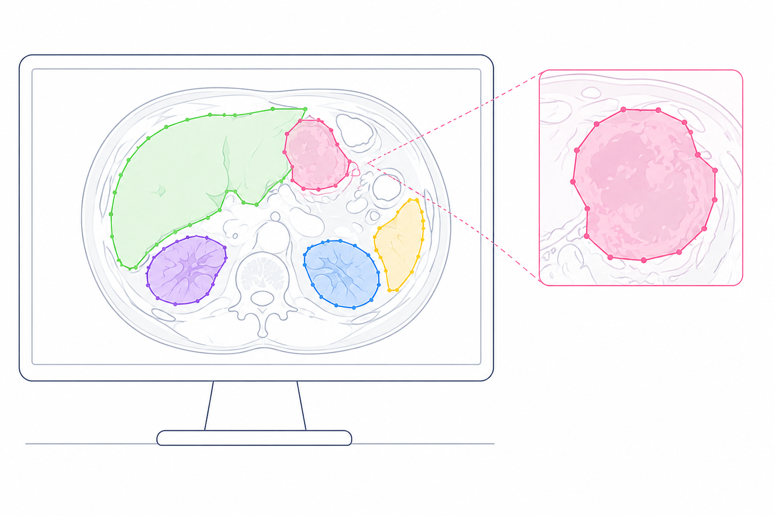 Polygon Annotations